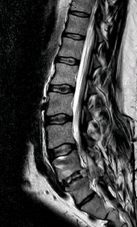 Mri Of Thumb